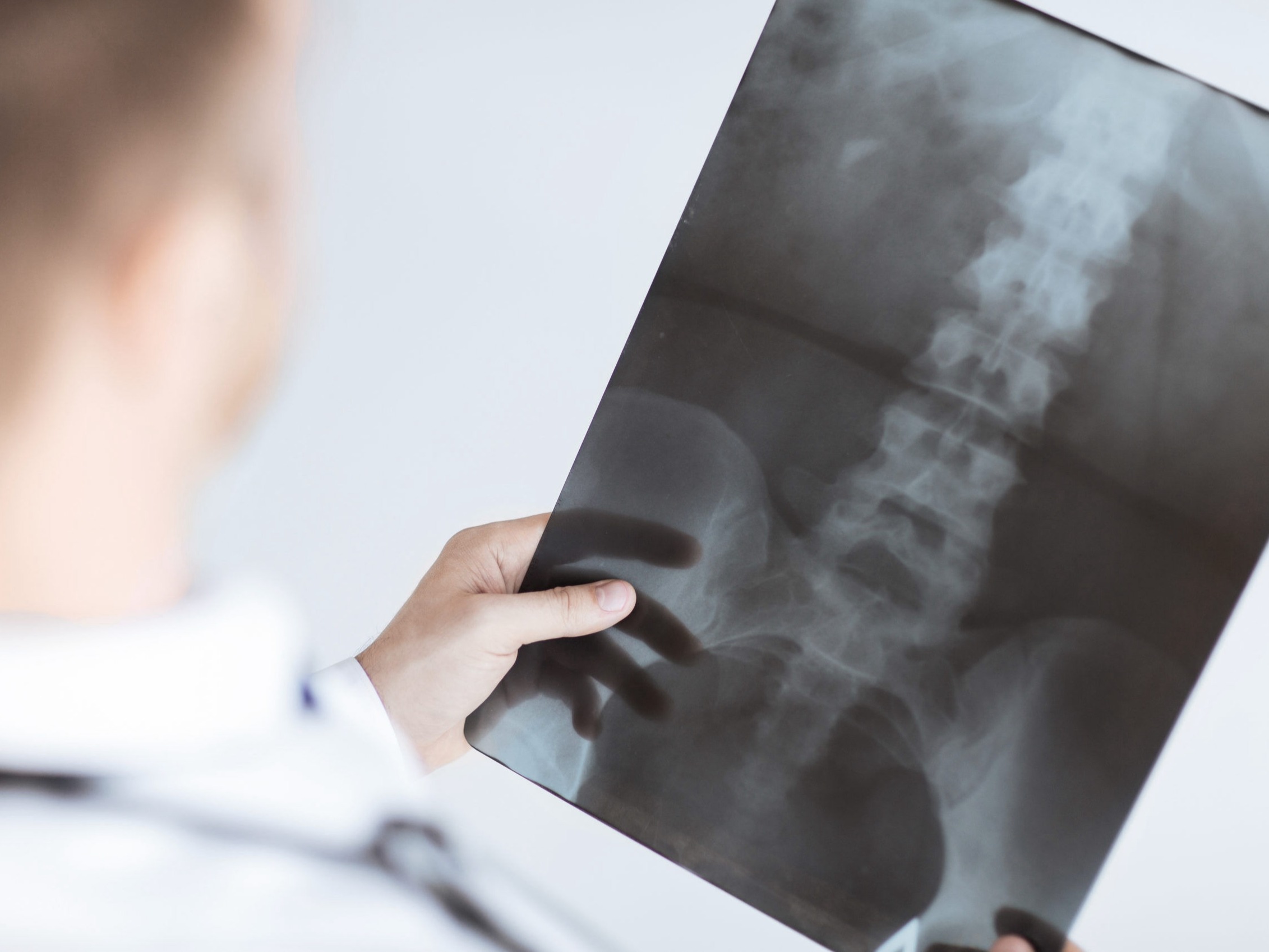 Cirurgia preservadora do quadril