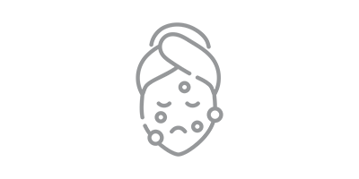 Dermatite seborreica