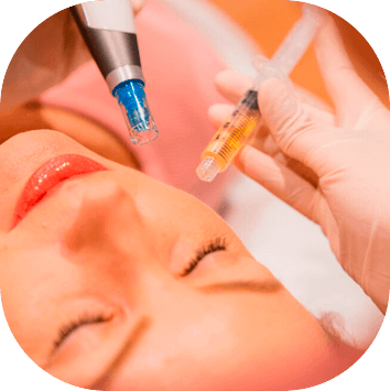 PRP Facial